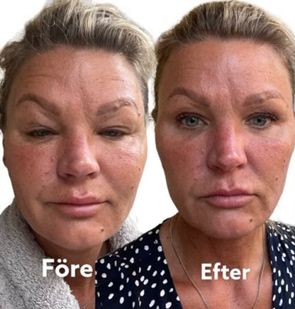 Organic Botox Kit